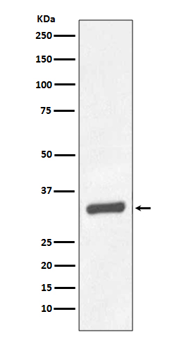 Prostate Specific Antigen Rabbit mAb