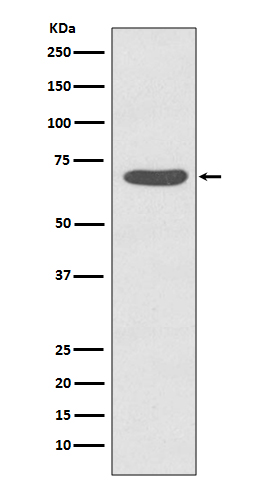 Phospho-PKC zeta (Thr560) Rabbit mAb