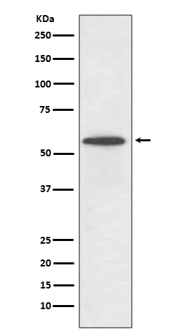 IRF5 Rabbit mAb