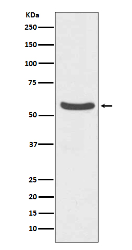 Glucose Transporter GLUT2 Rabbit mAb