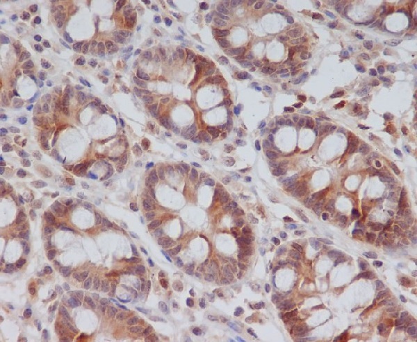 Cyclin B2 Rabbit mAb