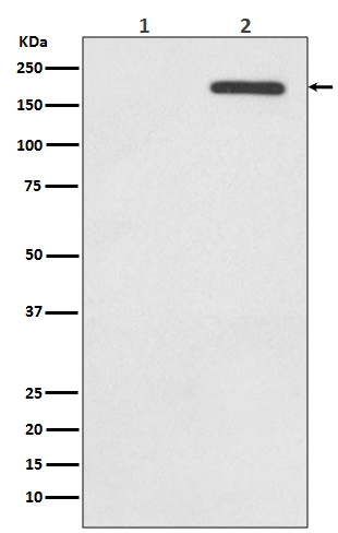 Phospho-EGFR (Tyr1068) Rabbit mAb