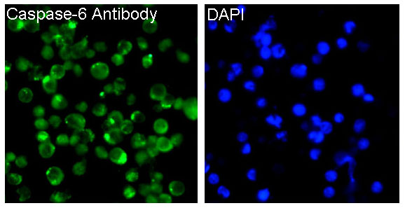 Caspase 6 Rabbit mAb