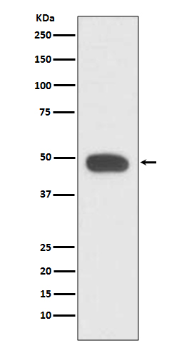 PAX6 Rabbit mAb