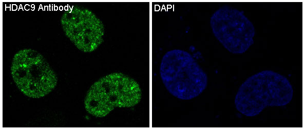 HDAC9 Rabbit mAb