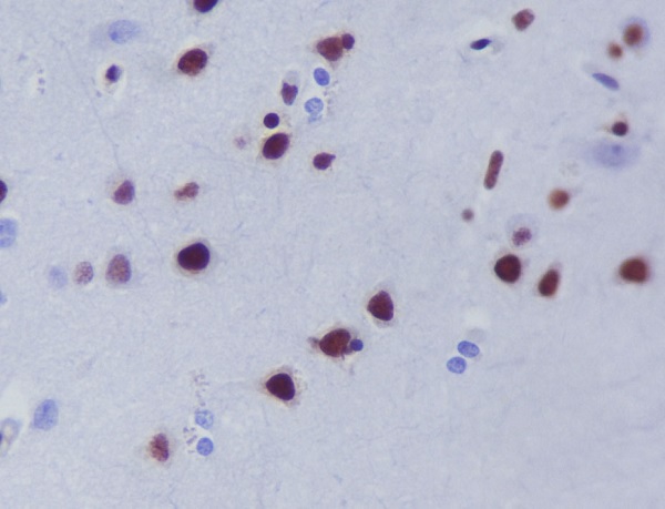 HDAC9 Rabbit mAb