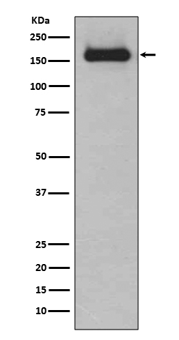 HDAC9 Rabbit mAb