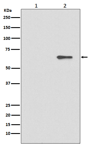 Phospho-AMPK alpha 2 (Ser491) Rabbit mAb