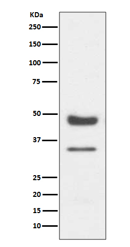 PAX6 Rabbit mAb