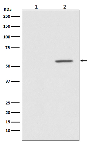 Phospho-AKT1 (Ser124) Rabbit mAb