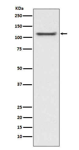 E1 Ubiquitin Activating Enzyme Rabbit mAb