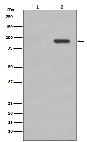 Phospho-beta Catenin (Ser33/Ser37) Rabbit mAb