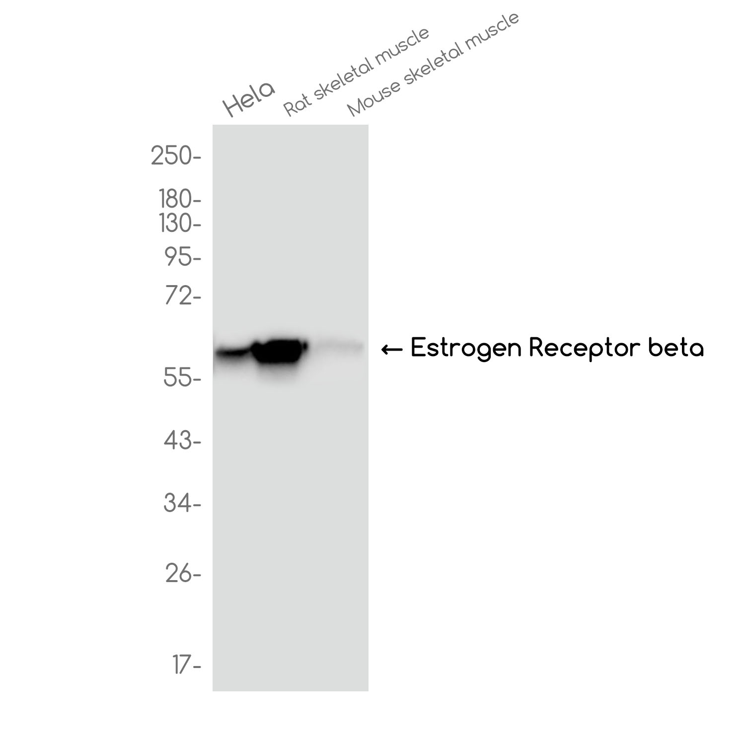 Estrogen Receptor beta Rabbit mAb