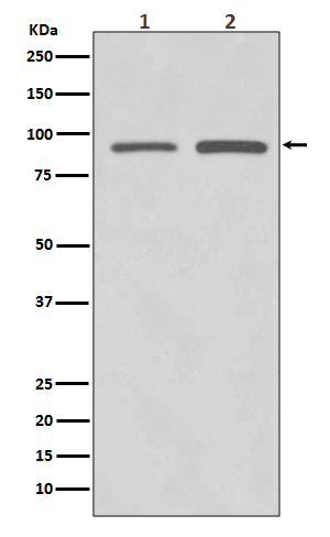 Polycomb Protein SUZ12 Rabbit mAb