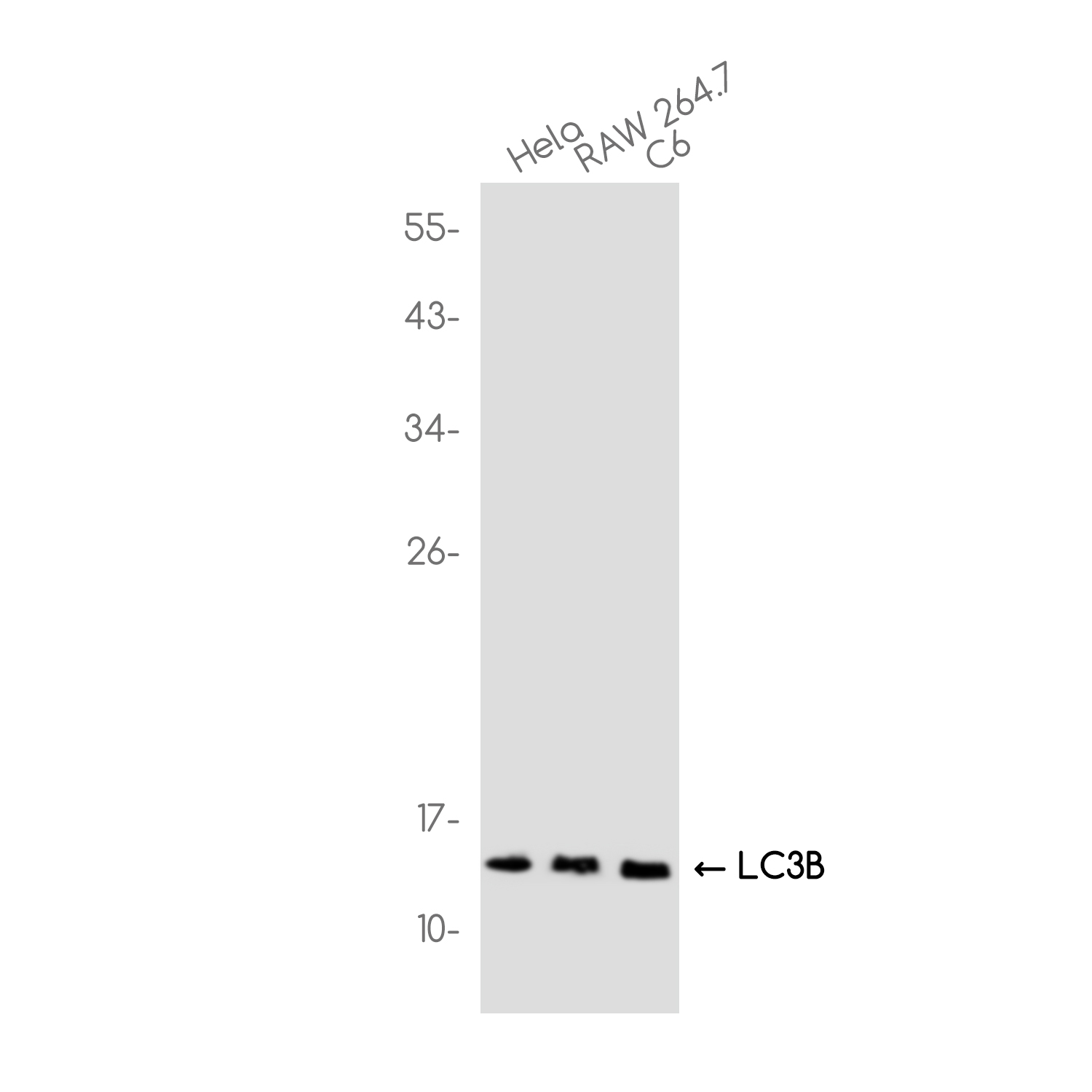 LC3B Rabbit mAb