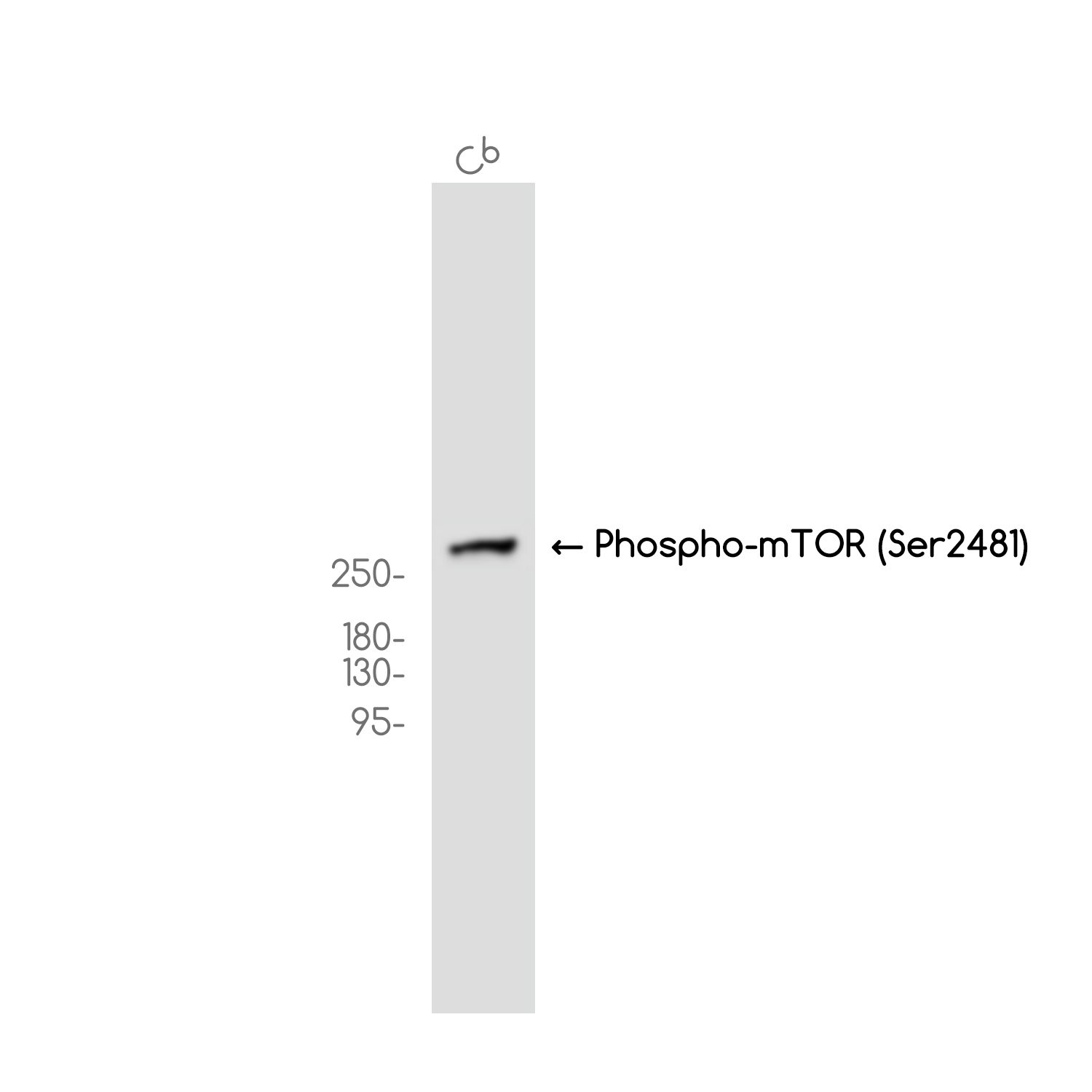 Phospho-mTOR (Ser2481) Rabbit mAb