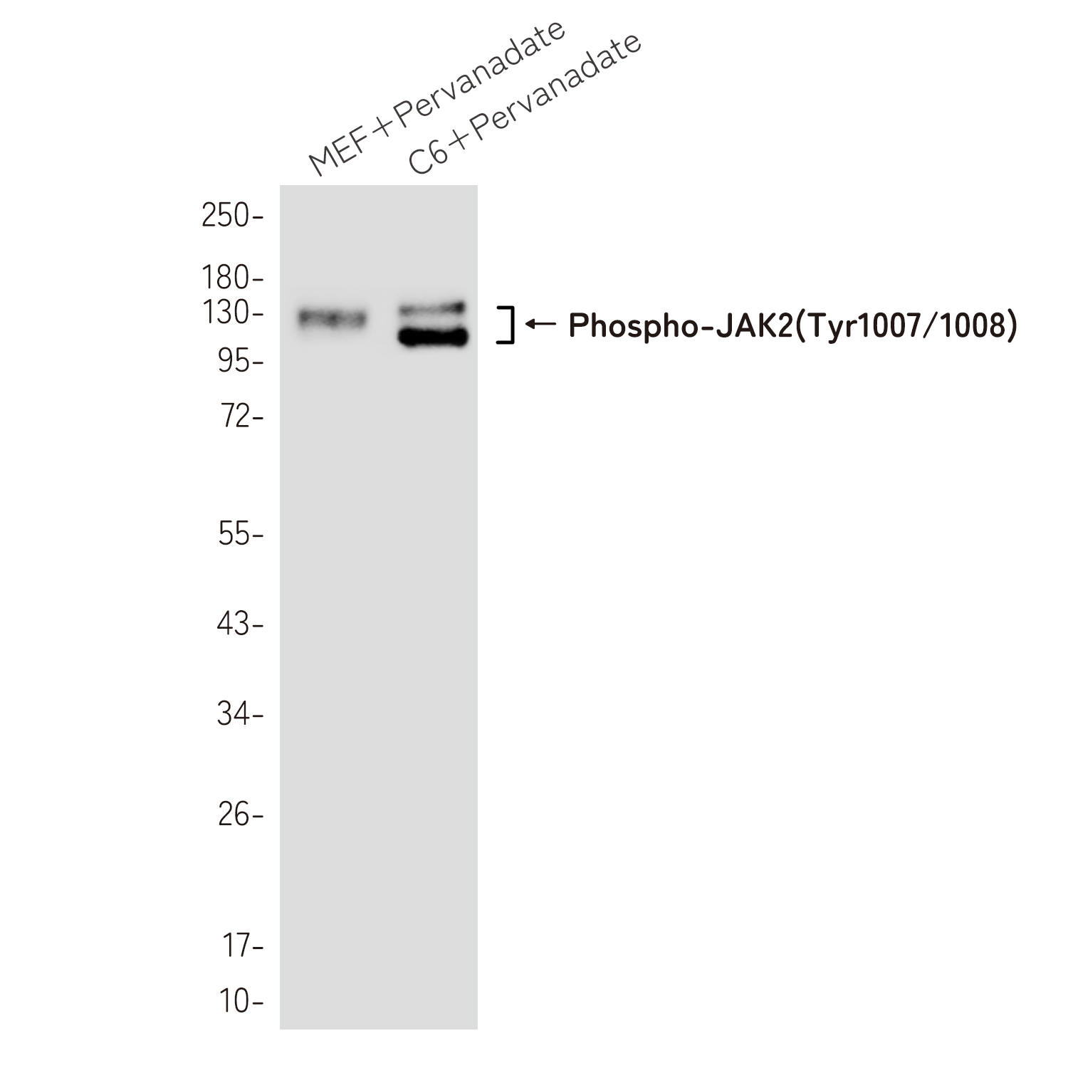 Phospho-JAK2 (Tyr1007/1008) Rabbit mAb