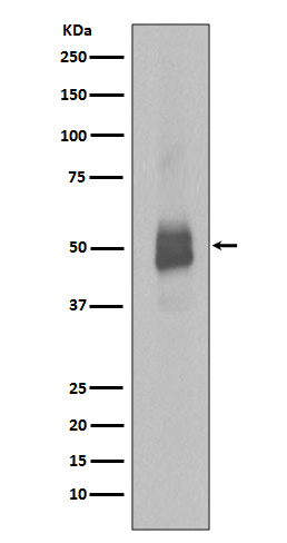 Phospho-Lyn (Tyr396) Rabbit mAb