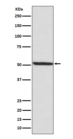 Phospho-IRF3 (Ser386) Rabbit mAb