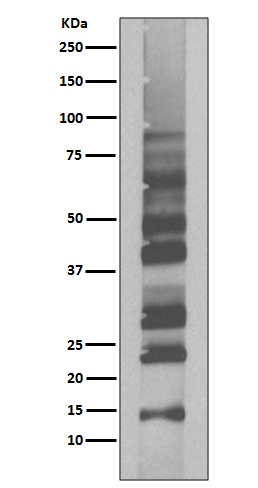 Ubiquitin K63 Rabbit mAb