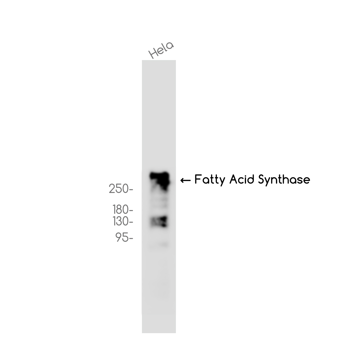 Fatty Acid Synthase Rabbit mAb