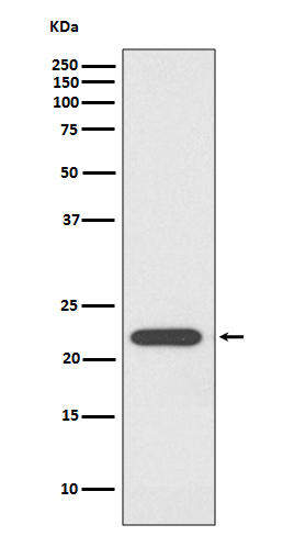 Peroxiredoxin 1 Rabbit mAb