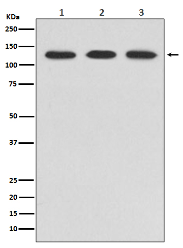 ABL2 Rabbit mAb