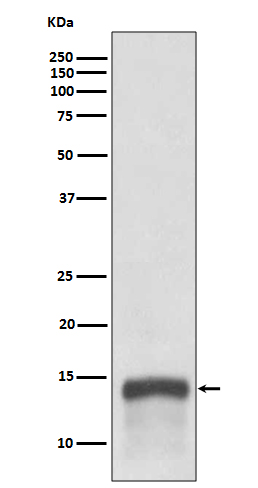 S100 alpha9 Rabbit mAb