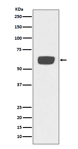 Tissue Type Plasminogen Activator Rabbit mAb