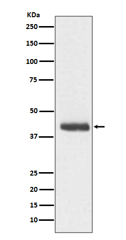 Doublecortin Rabbit mAb