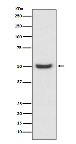 PDIA6 Rabbit mAb