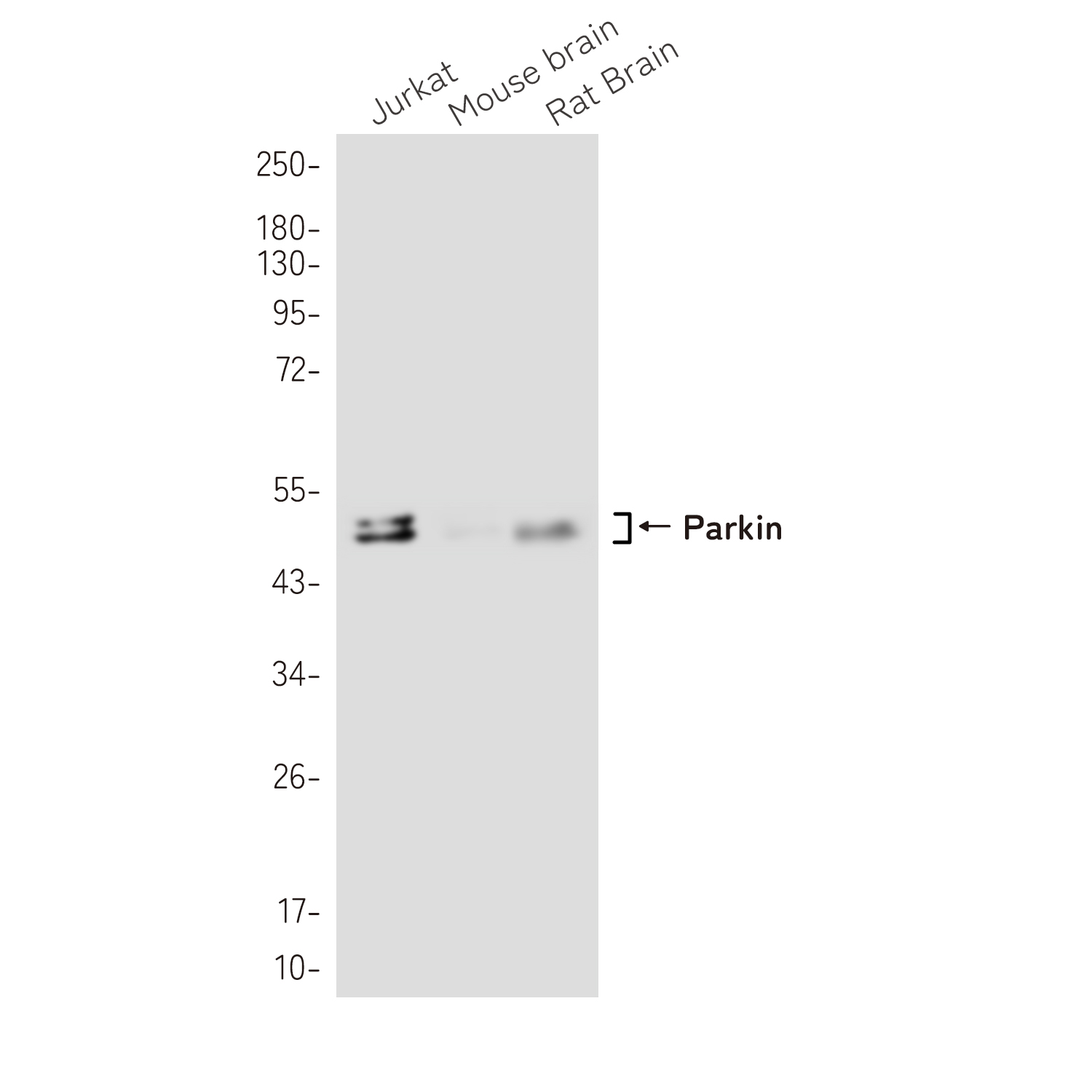 Parkin Rabbit mAb