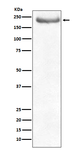 Neurofilament Heavy Polypeptide Rabbit mAb