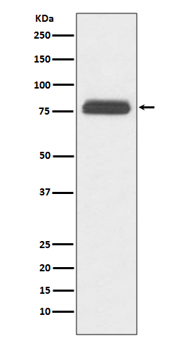 T Box Brain Protein 1 Rabbit mAb