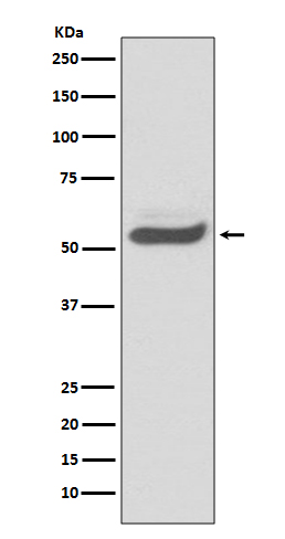 alpha 1-Antitrypsin Rabbit mAb