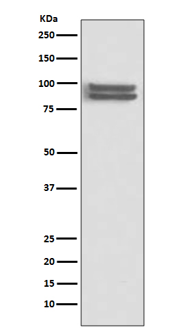 FOXP1 Rabbit mAb