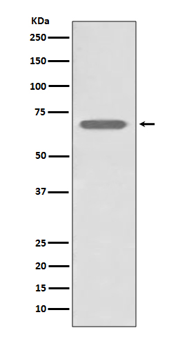 beta 2 Adrenergic Receptor Rabbit mAb