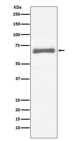 alpha 1 Fetoprotein Rabbit mAb