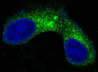 Carcino Embryonic Antigen CEA (CD66e) Rabbit mAb