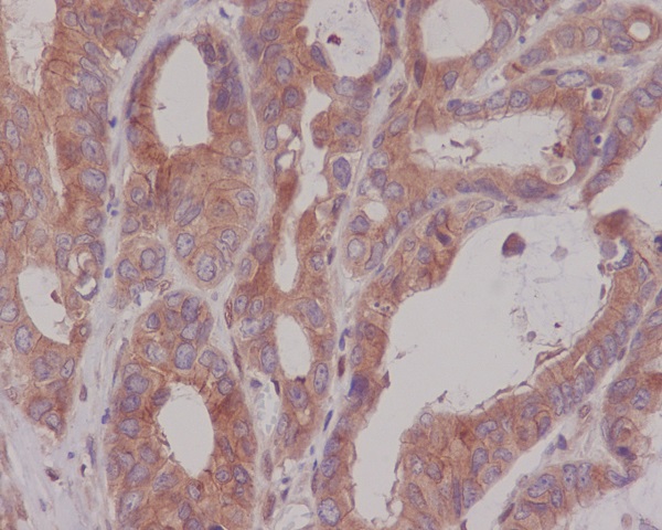 Carcino Embryonic Antigen CEA (CD66e) Rabbit mAb