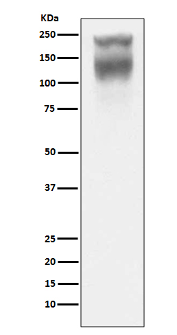 Carcino Embryonic Antigen CEA (CD66e) Rabbit mAb