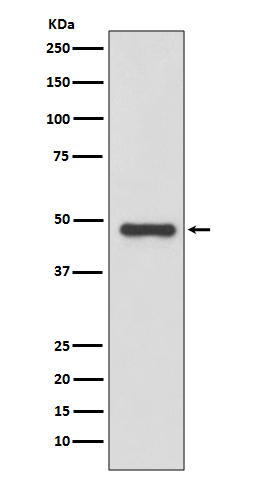 uPA Rabbit mAb