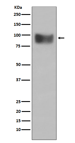 Interferon alpha/beta Receptor 1 Rabbit mAb