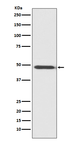 Myoblast Determination Protein 1 Rabbit mAb