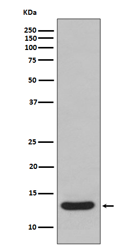 FABP1 Rabbit mAb