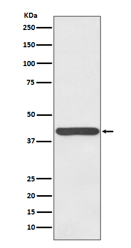 Haptoglobin Rabbit mAb