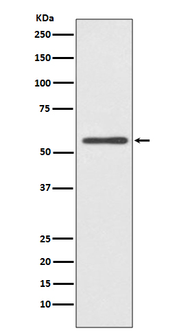 Cytochrome P450 2E1 Rabbit mAb