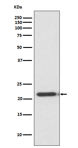 Metalloproteinase Inhibitor 2 Rabbit mAb