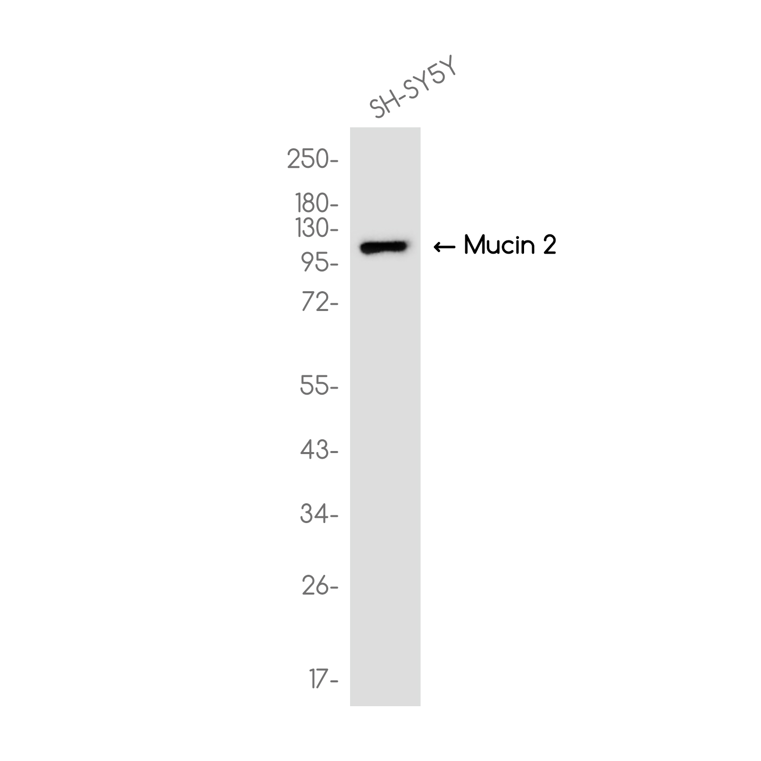 Mucin 2 Rabbit mAb