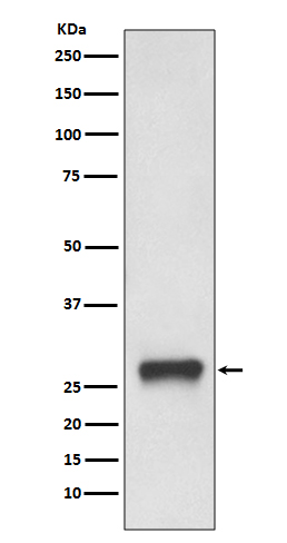 HLA DPB1 Rabbit mAb